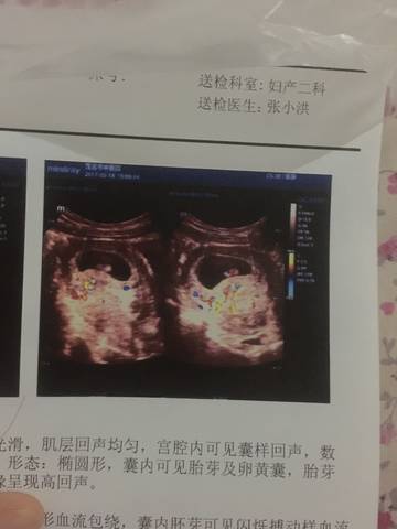 journal_insert_pic_744858769