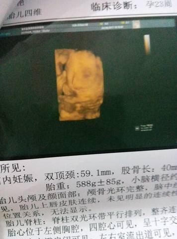 journal_insert_pic_745838714