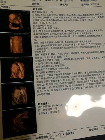 journal_insert_pic_750091762
