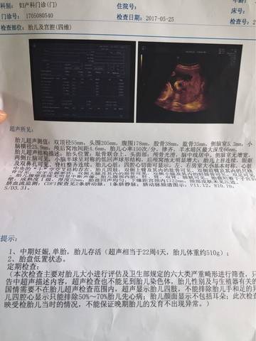 journal_insert_pic_753795008