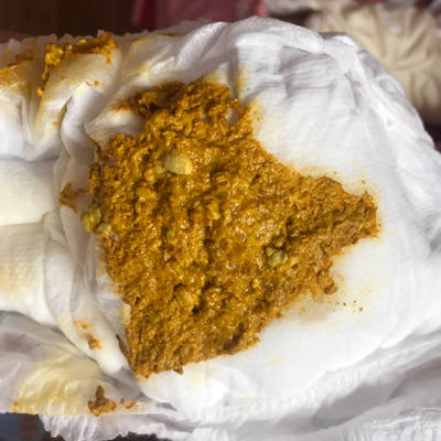 宝宝拉这样的屎什麼原因?里头有白泡泡