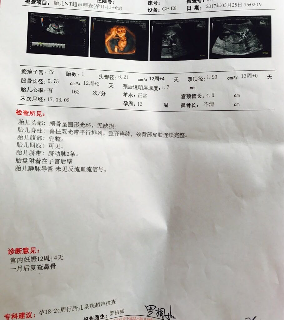 记录记录我的孕早期～愿大家都好孕