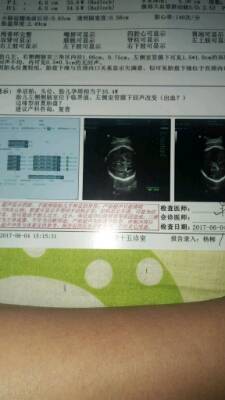 journal_insert_pic_759951506