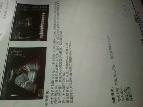journal_insert_pic_760877423