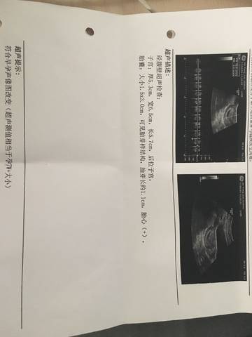 journal_insert_pic_760562454