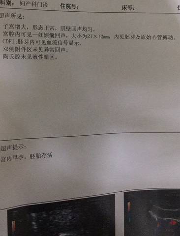 journal_insert_pic_760542859