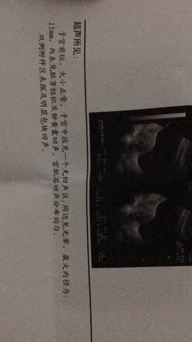 journal_insert_pic_761208550