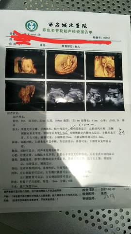 journal_insert_pic_762415328