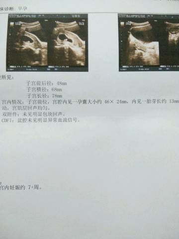 journal_insert_pic_762645367