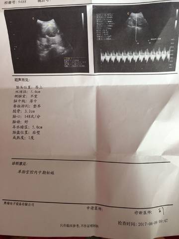 journal_insert_pic_763980130