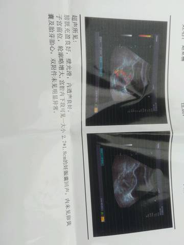 journal_insert_pic_766237750
