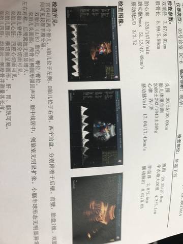 journal_insert_pic_767759366