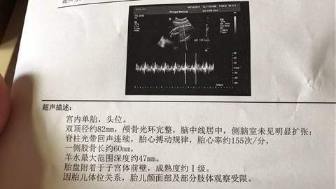 journal_insert_pic_767149307