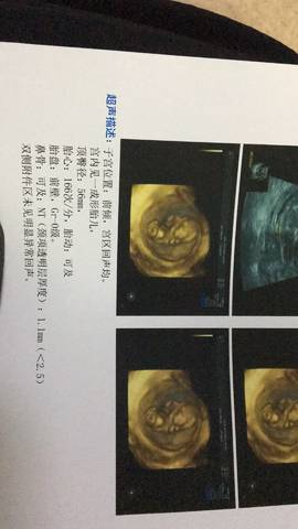 journal_insert_pic_768188298