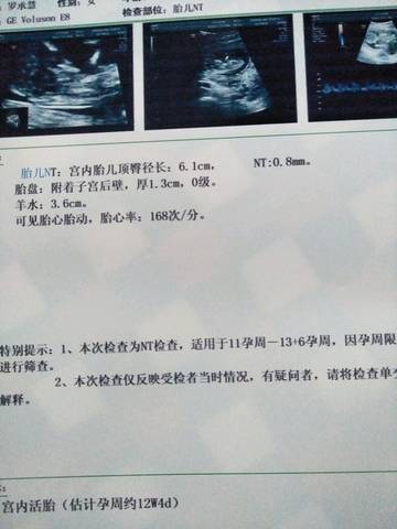 journal_insert_pic_769855292