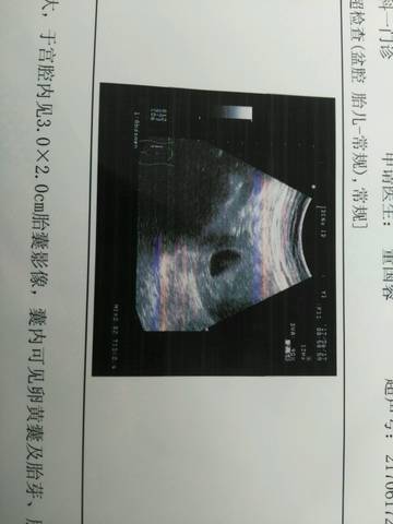 journal_insert_pic_770515205