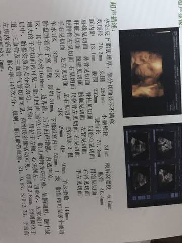 journal_insert_pic_772195293