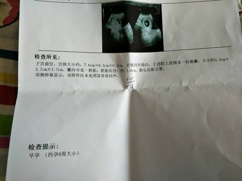 journal_insert_pic_776085908