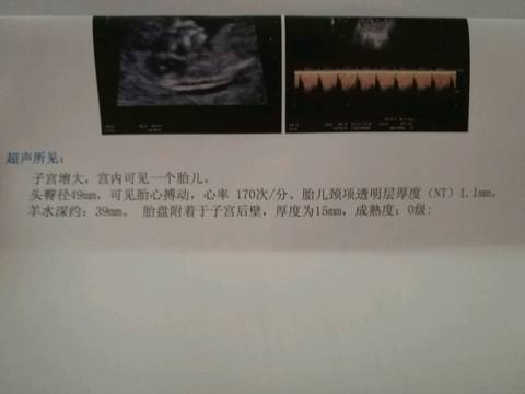 journal_insert_pic_776434460