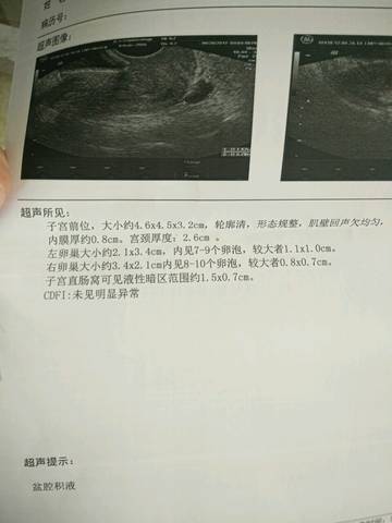 journal_insert_pic_778322144