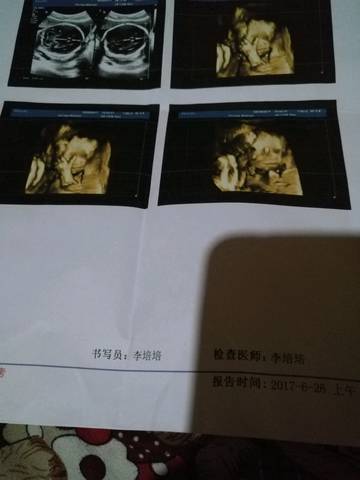 journal_insert_pic_778682915