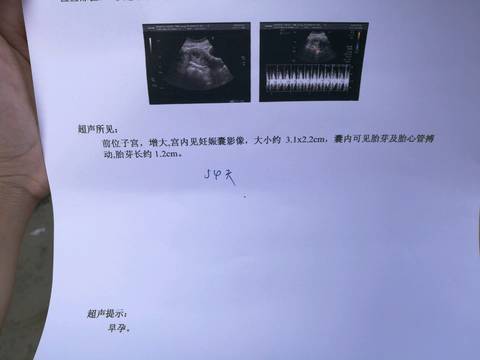 journal_insert_pic_778352108