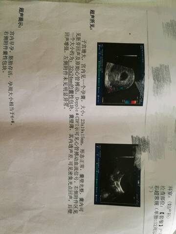 journal_insert_pic_779615851