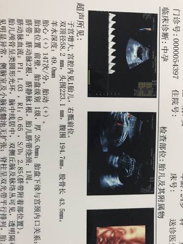 journal_insert_pic_781010606