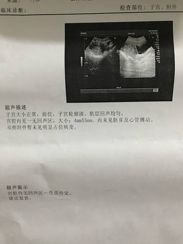 journal_insert_pic_783184761