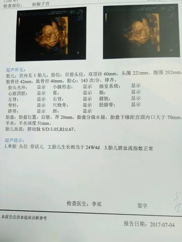 journal_insert_pic_783895019