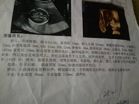 journal_insert_pic_784714728