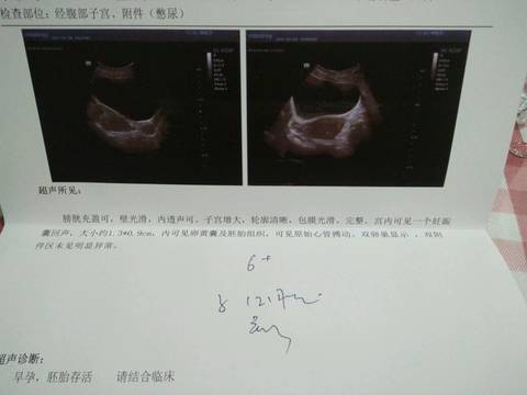 journal_insert_pic_785470969