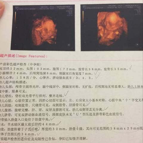 journal_insert_pic_786428077