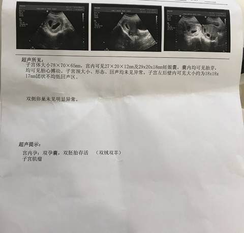 journal_insert_pic_789480359