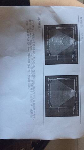 journal_insert_pic_790424323