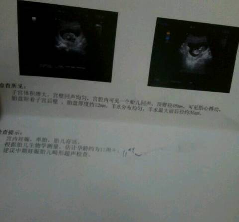 journal_insert_pic_791351112
