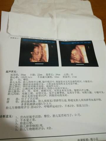 journal_insert_pic_791207384