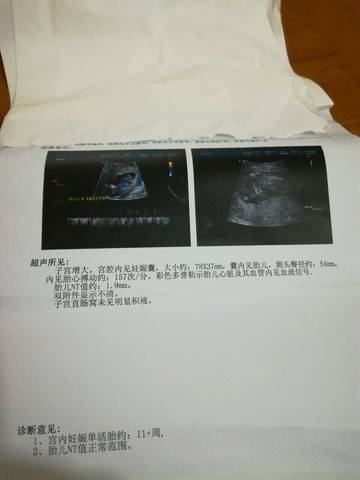 journal_insert_pic_791207381