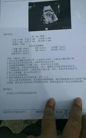 journal_insert_pic_792012747