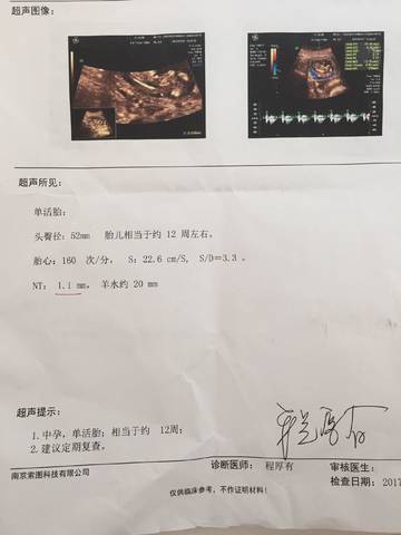 journal_insert_pic_793550149