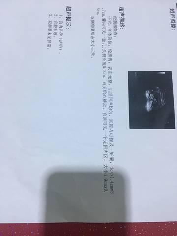 journal_insert_pic_794244933