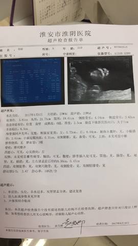 journal_insert_pic_794480045