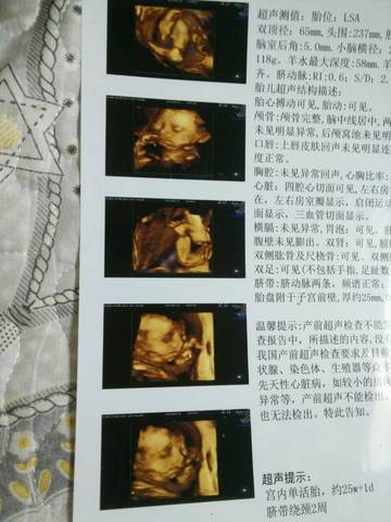 journal_insert_pic_795206141