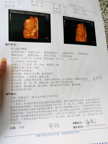 journal_insert_pic_794863866