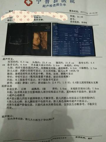 journal_insert_pic_796734072