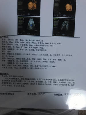 journal_insert_pic_796740997