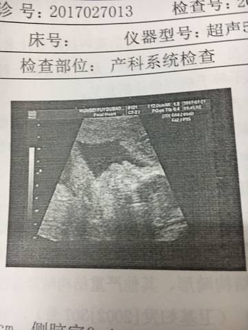 journal_insert_pic_796460435
