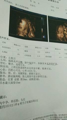 journal_insert_pic_797202356