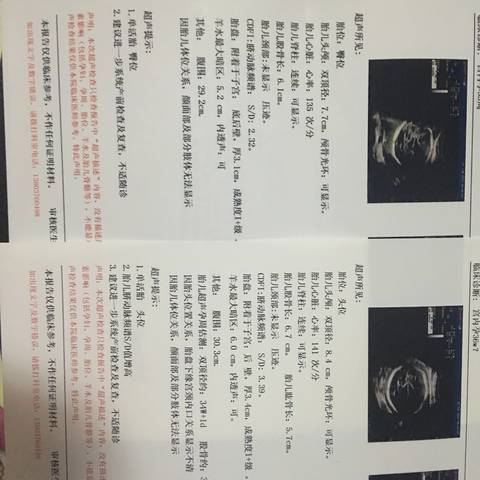 journal_insert_pic_798299125