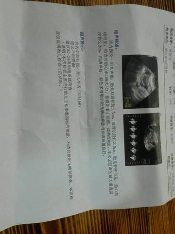journal_insert_pic_798553557
